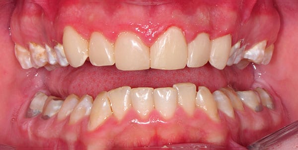 Before and After at Dakota Smiles!