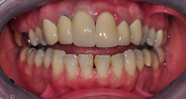Before and After at Dakota Smiles!