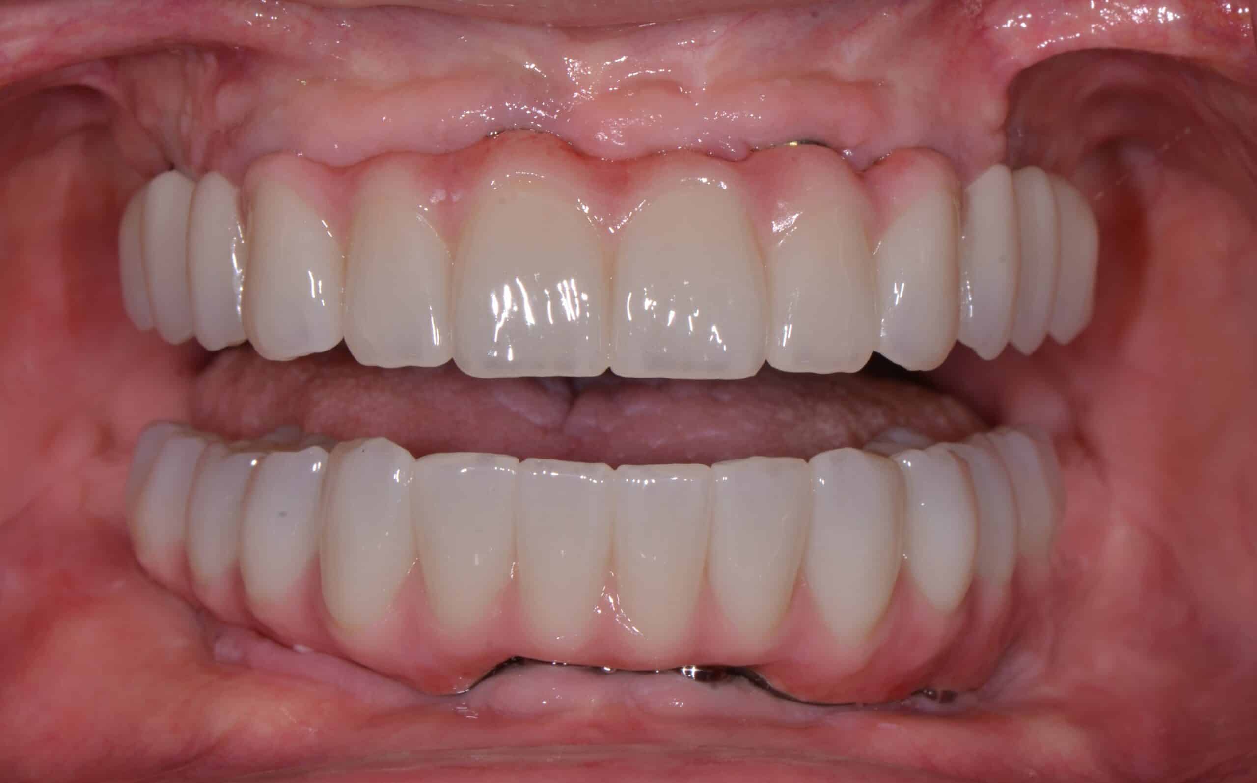 Before and After at Dakota Smiles!
