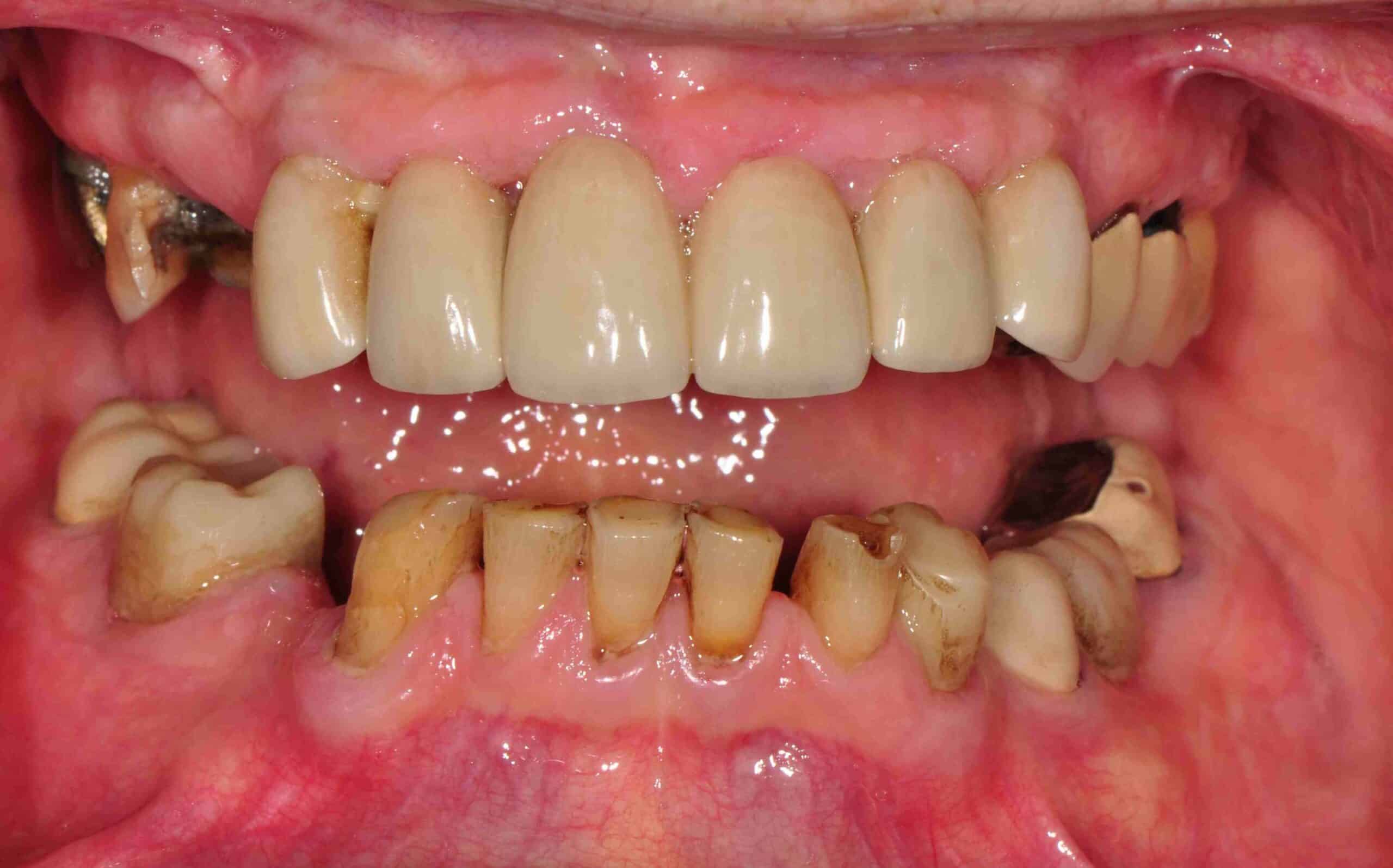 Before and After at Dakota Smiles!