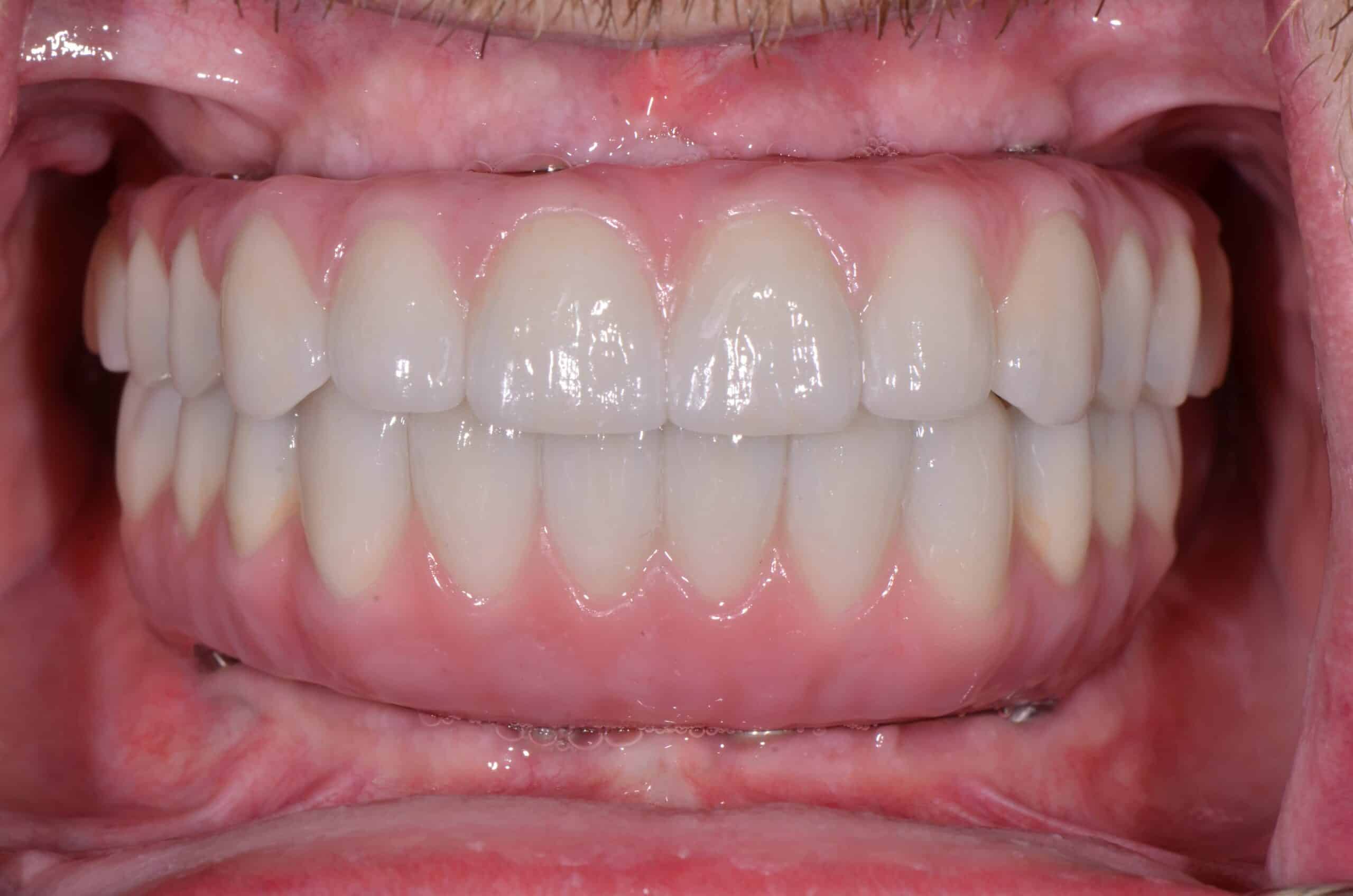Before and After at Dakota Smiles!