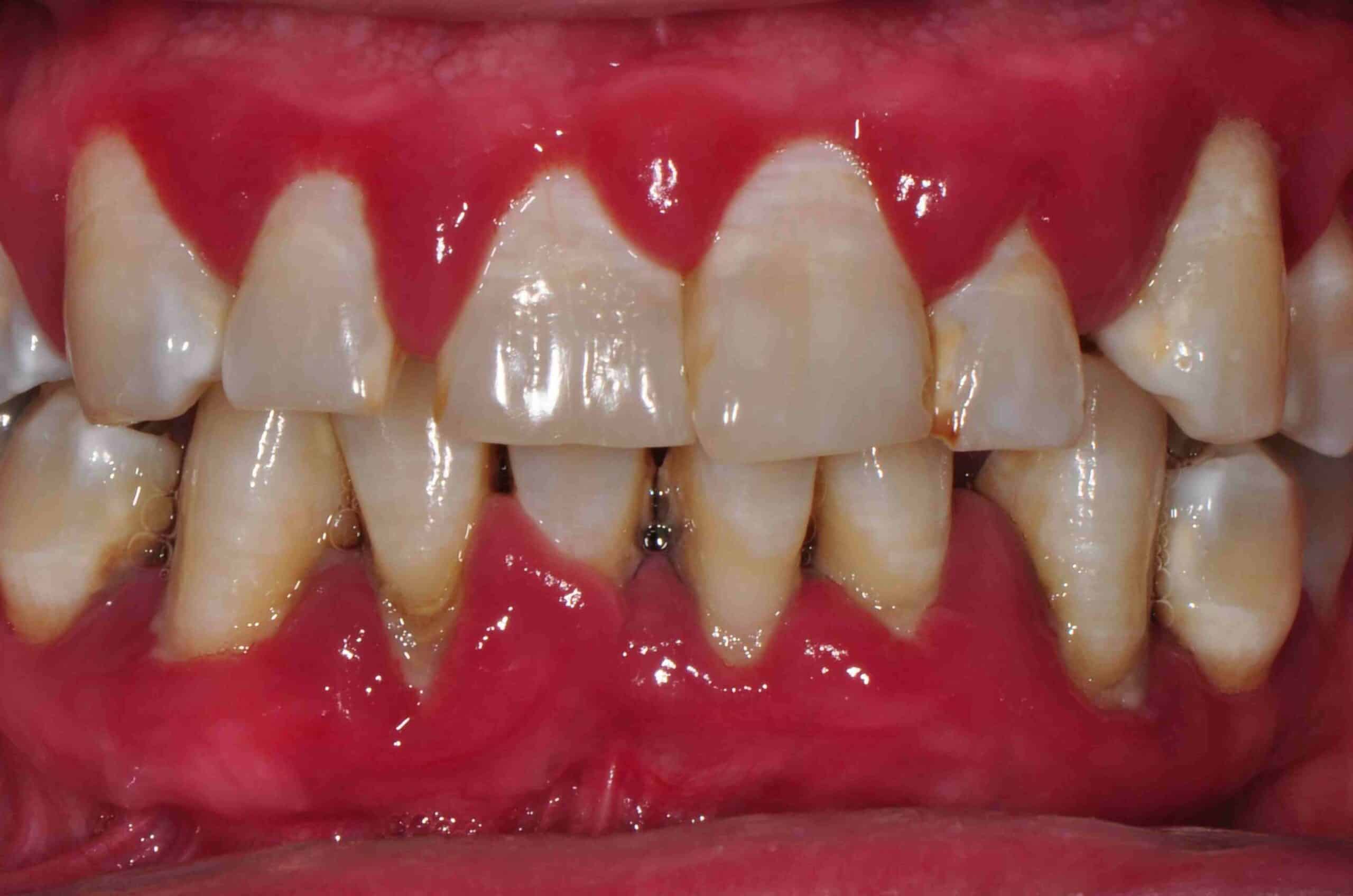 Before and After at Dakota Smiles!