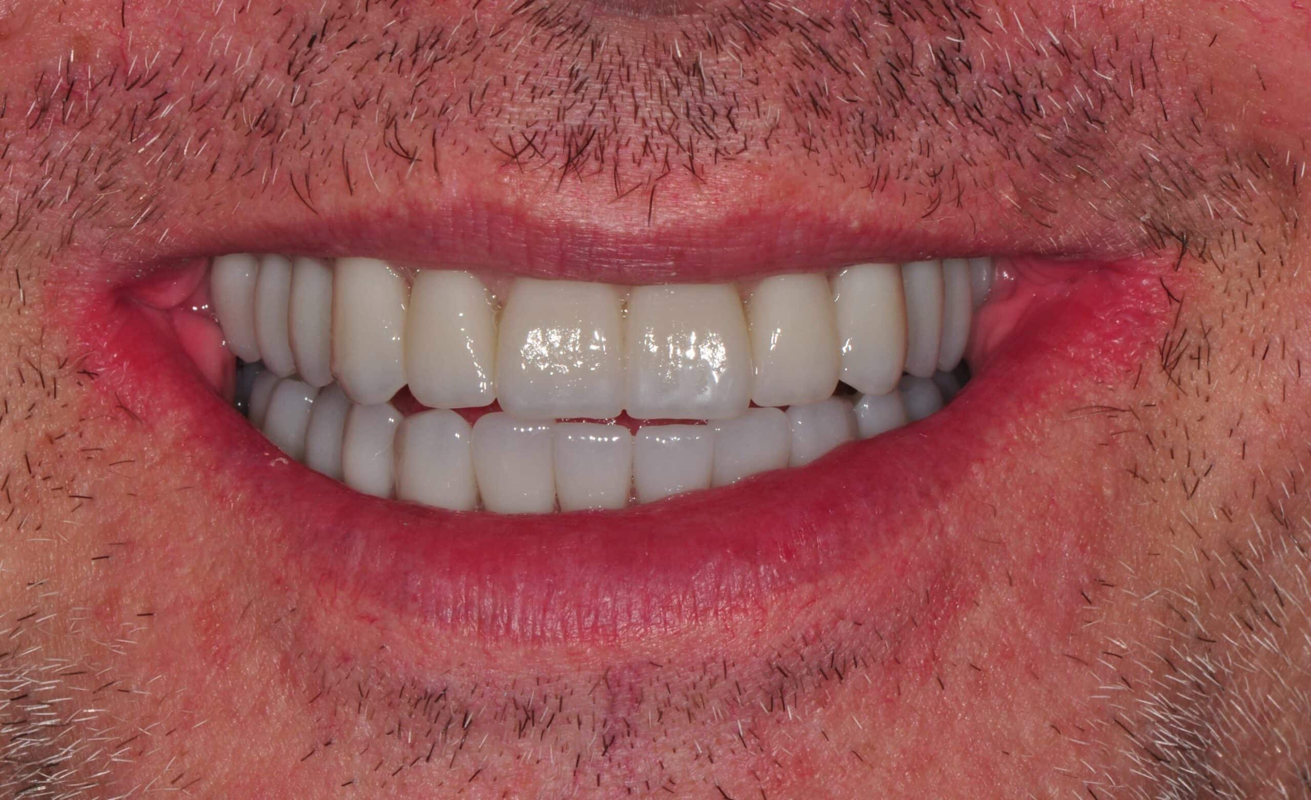 Before and After at Dakota Smiles!