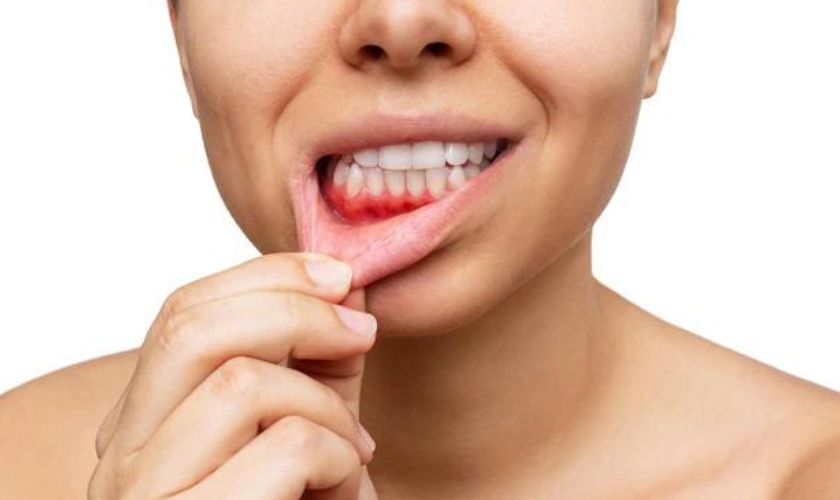 Best Treatment For Periodontal Disease