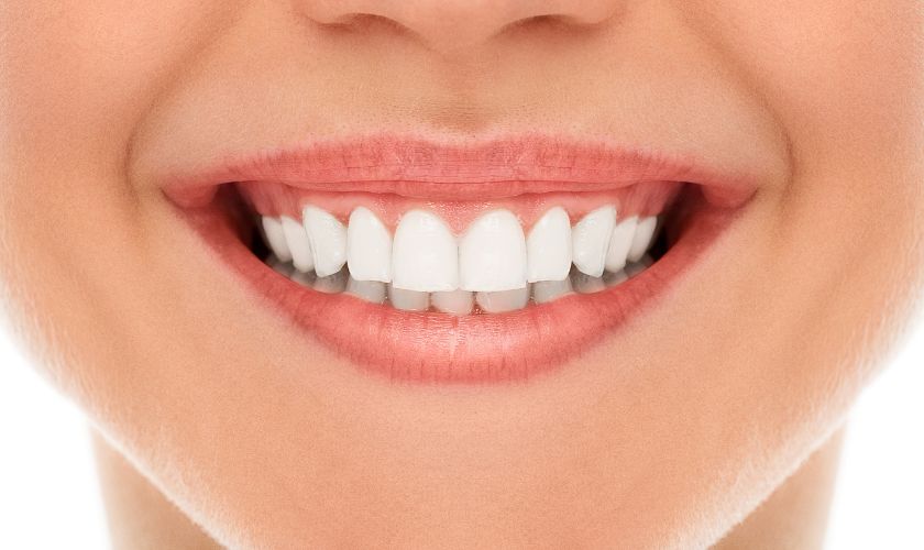 Teeth whitening in Fargo, ND