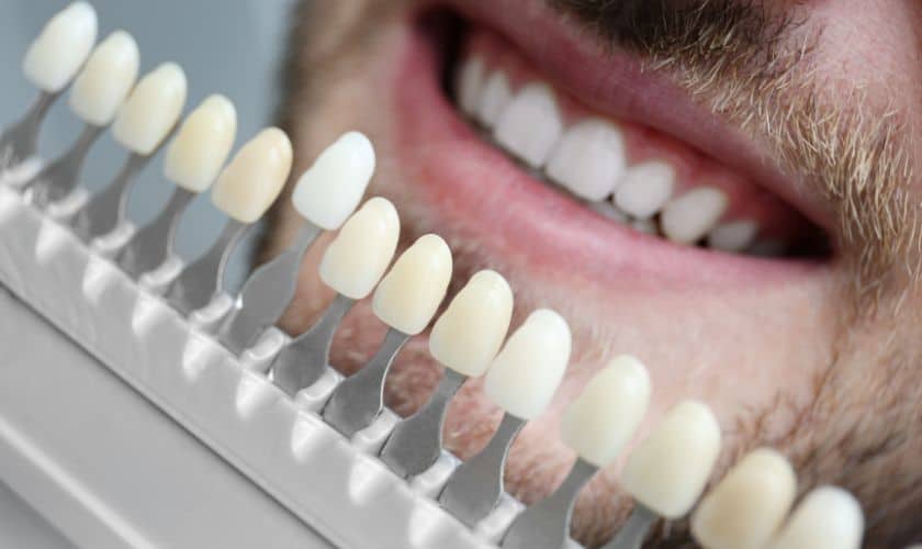Choosing The Right Dentist For Your Veneers: Factors To Consider