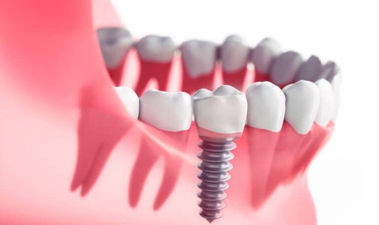 Emergency Dental Care: Why Fargo Residents Should Have a Plan In Place