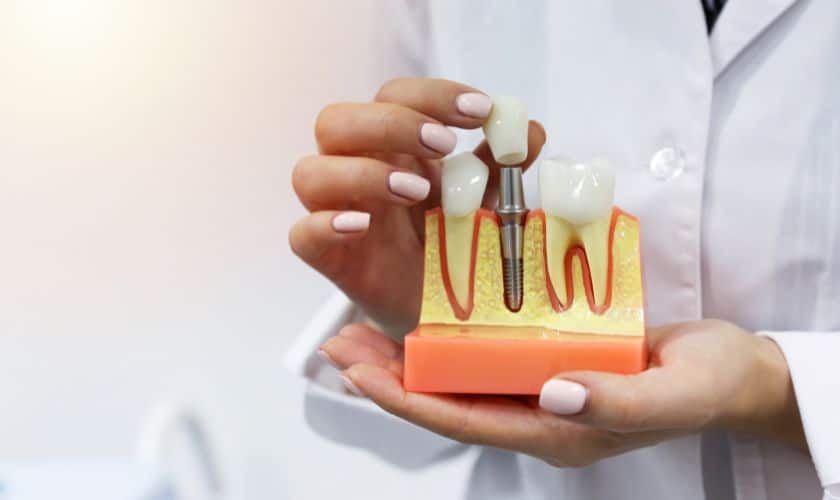 Dentist in white coat holding dental implant model showing prosthetic tooth components