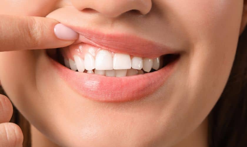 Person displaying bright, healthy smile with finger pointing to teeth against blurred background.