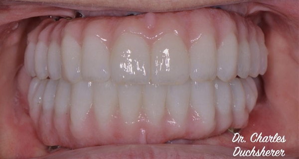 Before and After at Dakota Smiles!