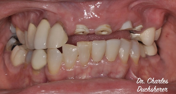Before and After at Dakota Smiles!