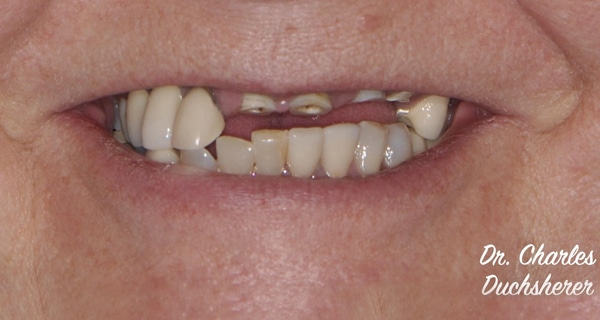 Before and After at Dakota Smiles!