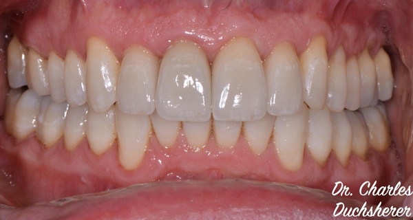 Before and After at Dakota Smiles!