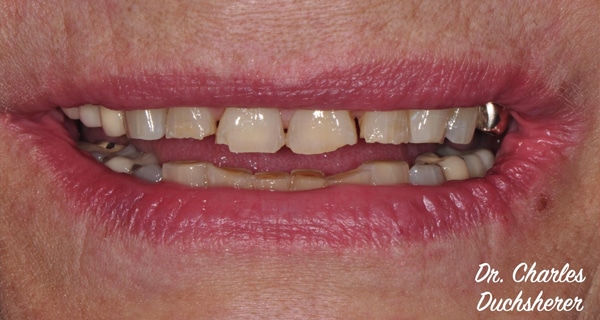 Before and After at Dakota Smiles!