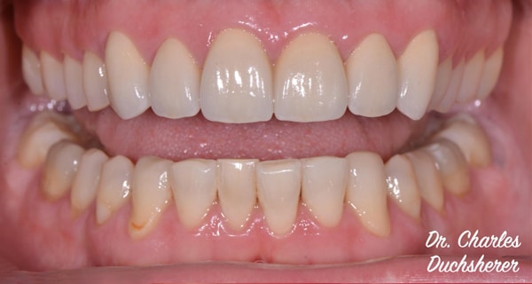 Before and After at Dakota Smiles!