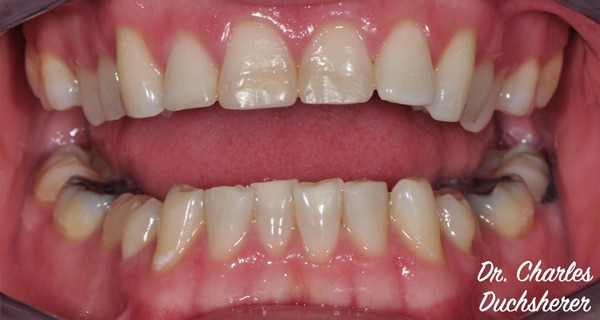 Before and After at Dakota Smiles!