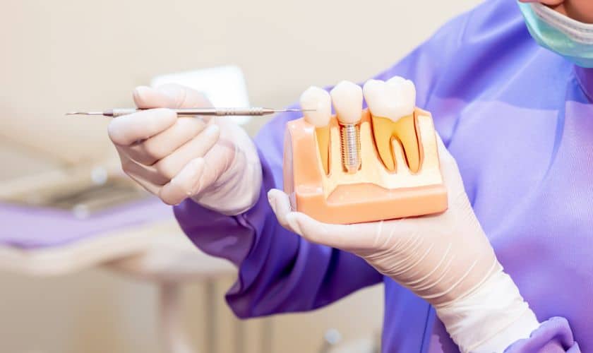 Dentist in purple gloves holding dental model and shade guide for tooth color matching.
