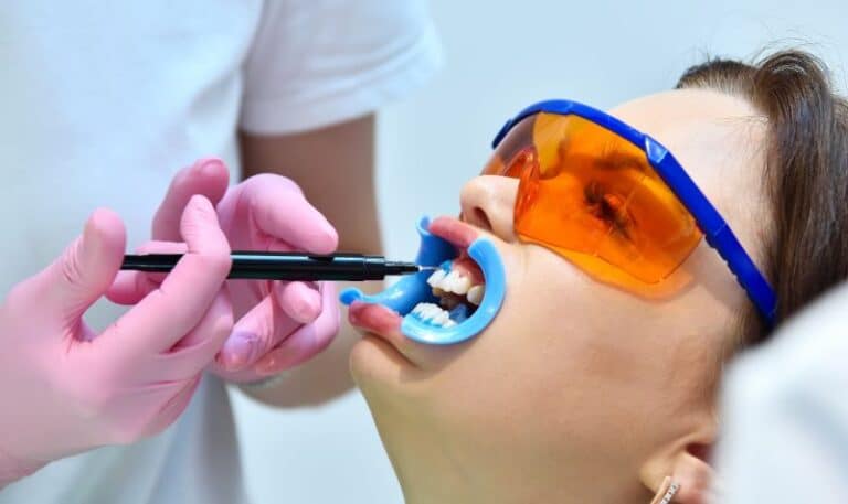 Tooth Whitening Gel