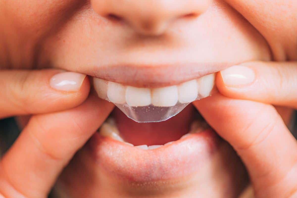 Whitening Strips