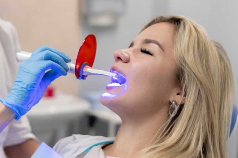 Teeth Discolor