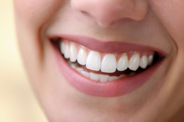 Benefits of Using Vaseline on Your Teeth
