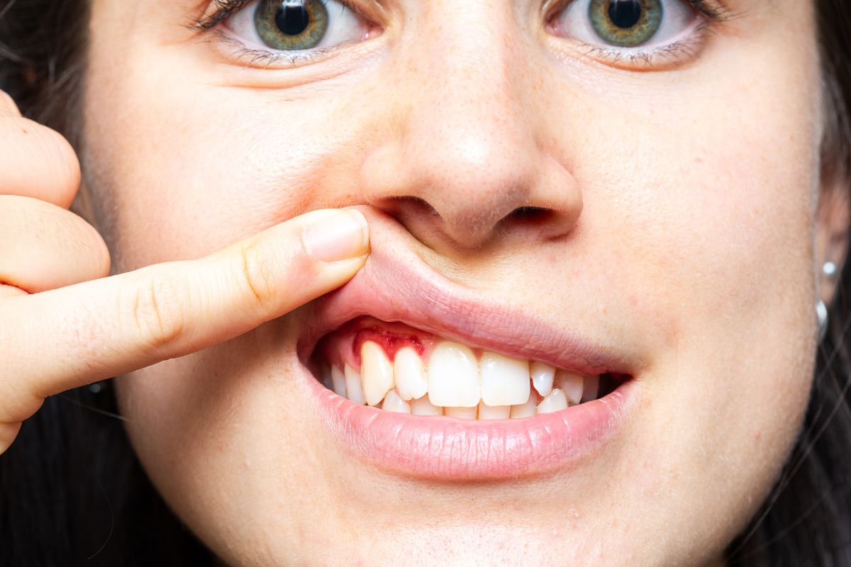 Cosmetic Dentistry Effectively Fix Receding Gums