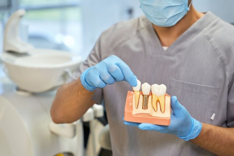 dental implants fargo