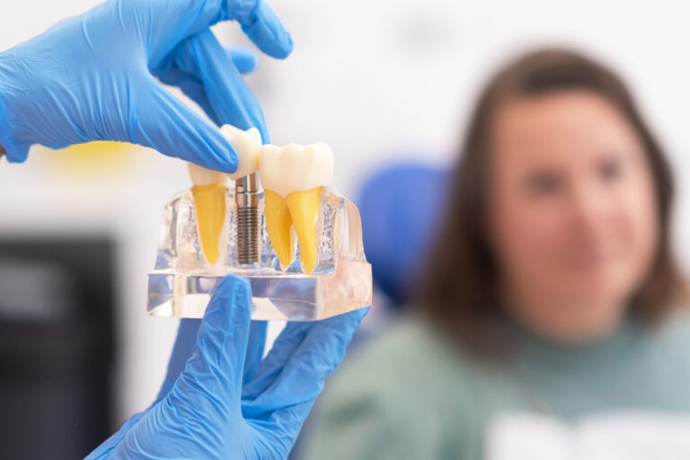 dental implants fargo