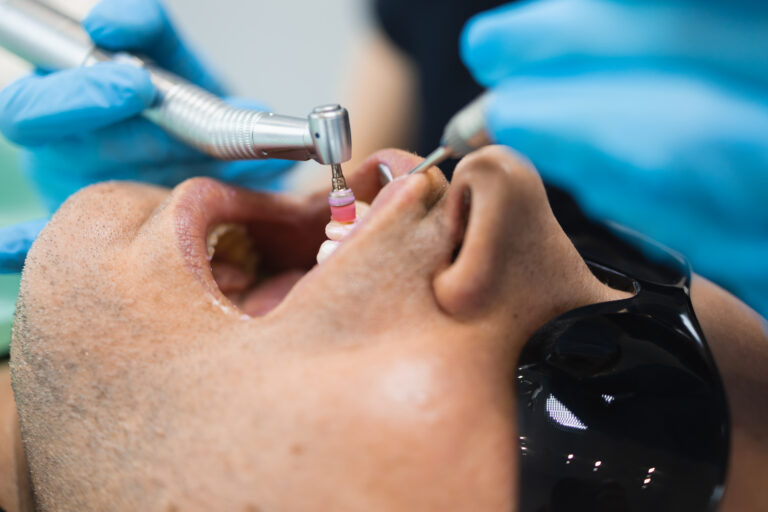 cosmetic dentistry fargo