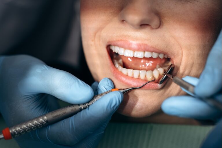 How Regular Visits to a Dentist Can Help Prevent Gum Disease