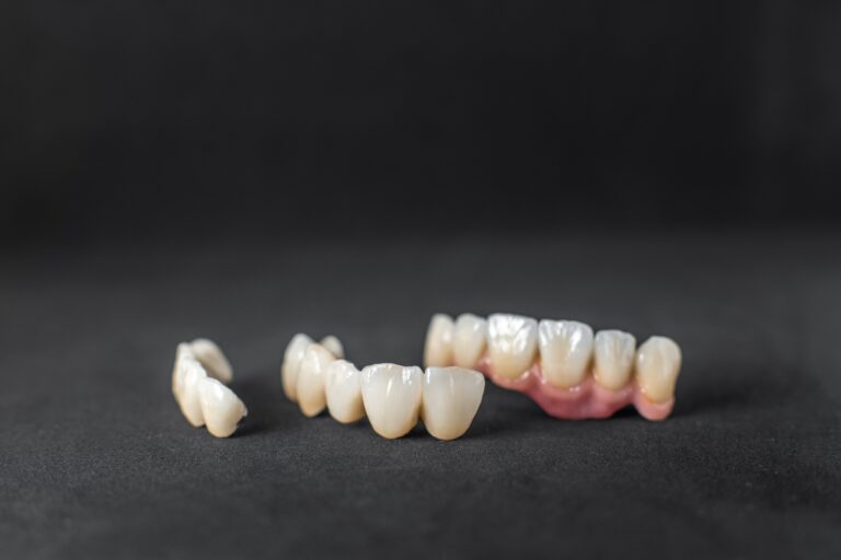 What Should You Do If Your Temporary Crown Breaks