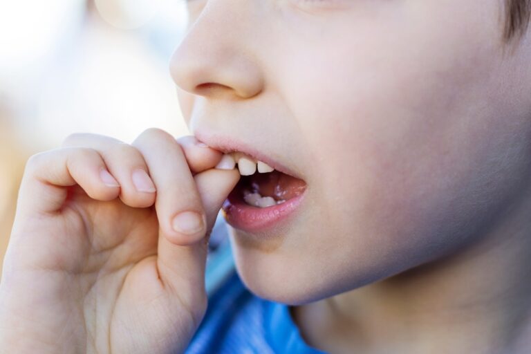 Can A Loose Tooth Tighten Up Again