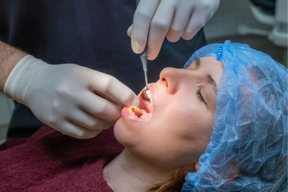 Can Half-Broken Teeth Be Fixed