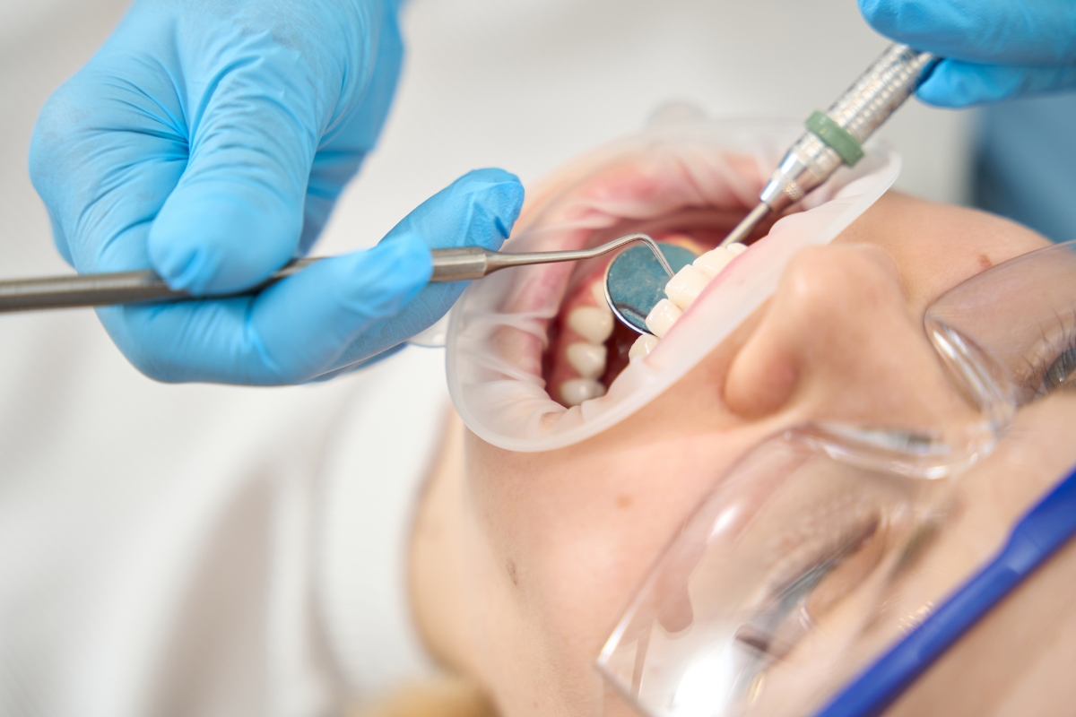 How Long Do Dental Stitches Take to Dissolve