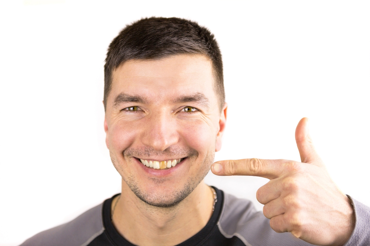 Tooth Turning Black But No Pain Discover the Reasons