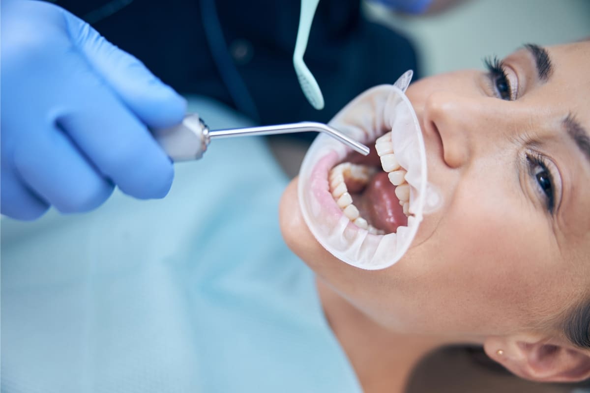 What Happens If You Don’t Get a Cavity Filled The Risks of Waiting.